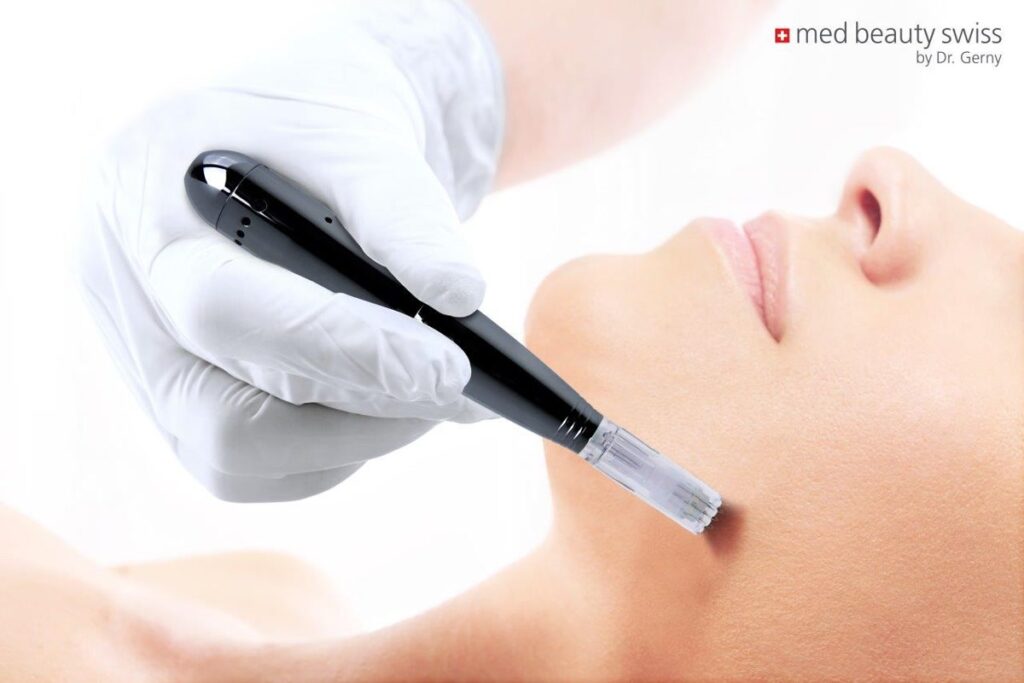 Microneedling Anti-Aging